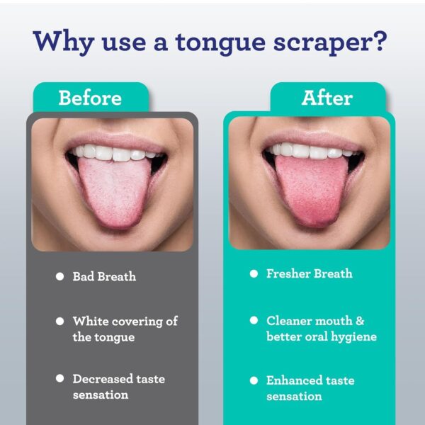 GuruNanda Tongue Scraper for Adults (2 Pack) with Travel Case, 420 Medical-Grade 100% Stainless Steel Tongue Cleaner, Aids in Fresh Breath & Oral Care - Image 6