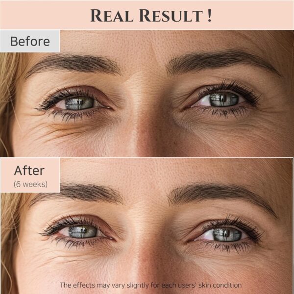 Beauty of Joseon Revive Eye Serum with Retinal Niacinamide Correction for Puffy Eye Bags Fine Lines Dark Circles Wrinkles, Korean Skin Care 30ml, 1 fl.oz - Image 9